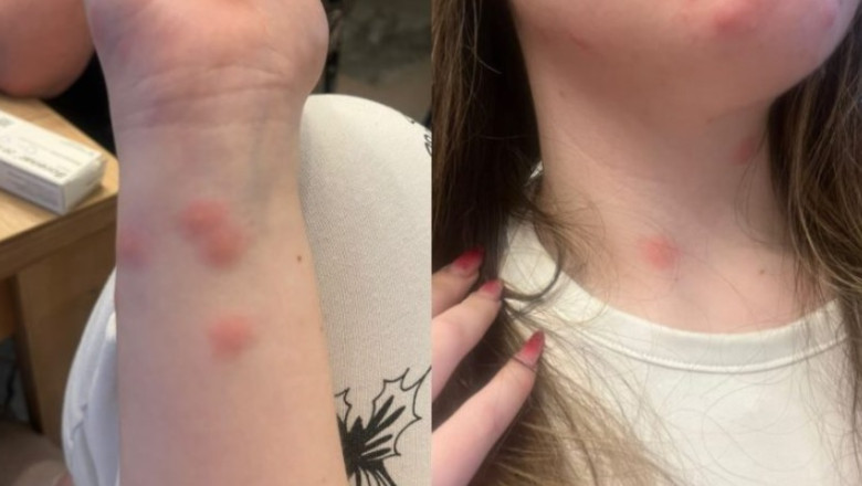 O experiență de coșmar în trenul CFR! O tânără s-a trezit în spital după o călătorie la cușetă, deși plătise 190 de lei pe bilet
