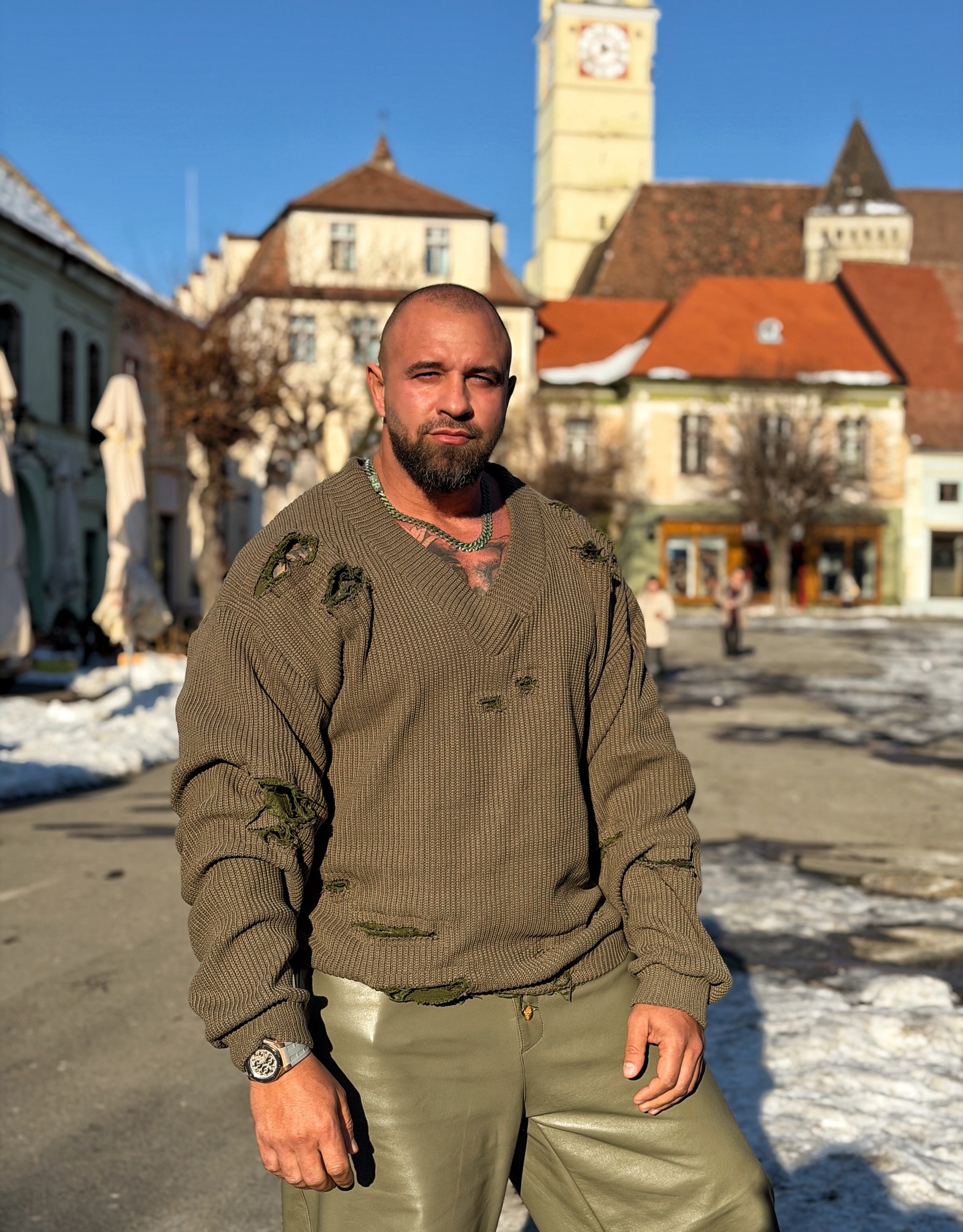 Alex Bodi, intervenție chirurgicală COMPLICATĂ: „Puteam să fac hemoragie internă”