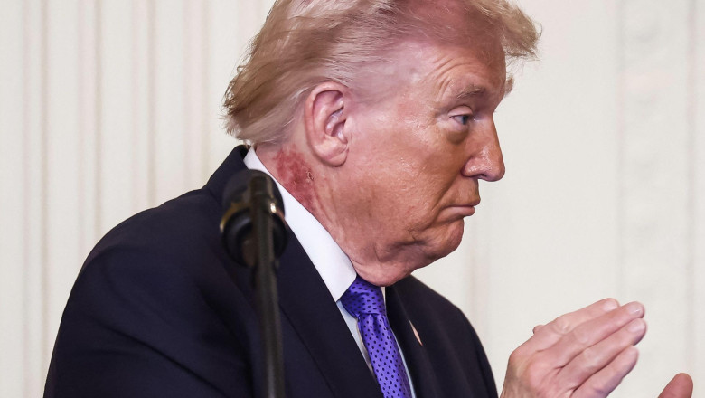 SPECULAȚII privind starea de sănătate a lui Donald Trump. Ce a ridicat semne de întrebare